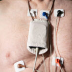 Can a Holter Monitor Detect Sleep Apnea