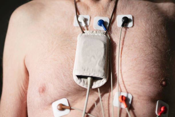 Can a Holter Monitor Detect Sleep Apnea